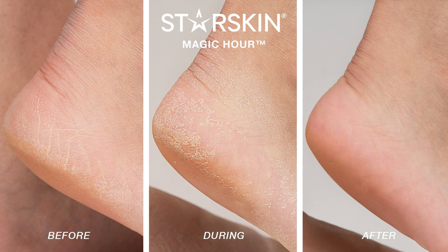Peeling Foot Mask Socks – Single | Magic Hour